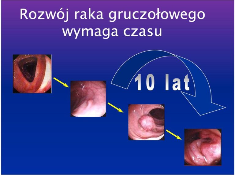 diagnostyka-raka-jelita-grubego-proktosonomed